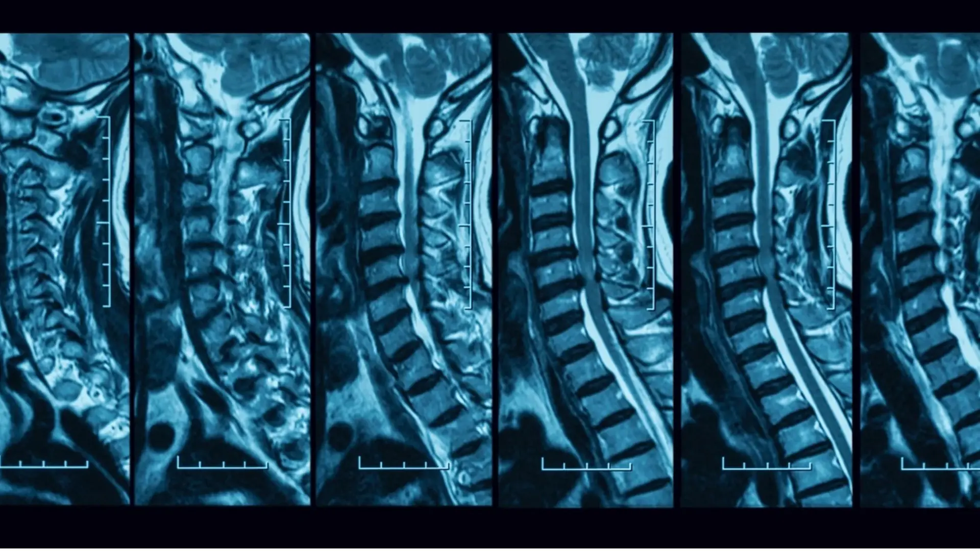 Images IRM utilisées pour illustrer les données médicales numériques